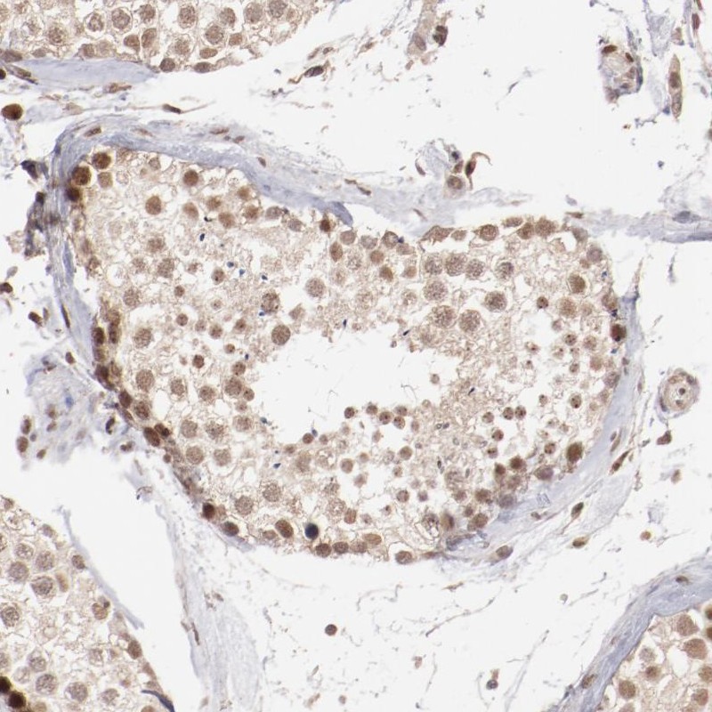 Atlas Antibodies Anti-CLOCK Antibody