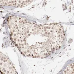 Atlas Antibodies Anti-CLOCK Antibody