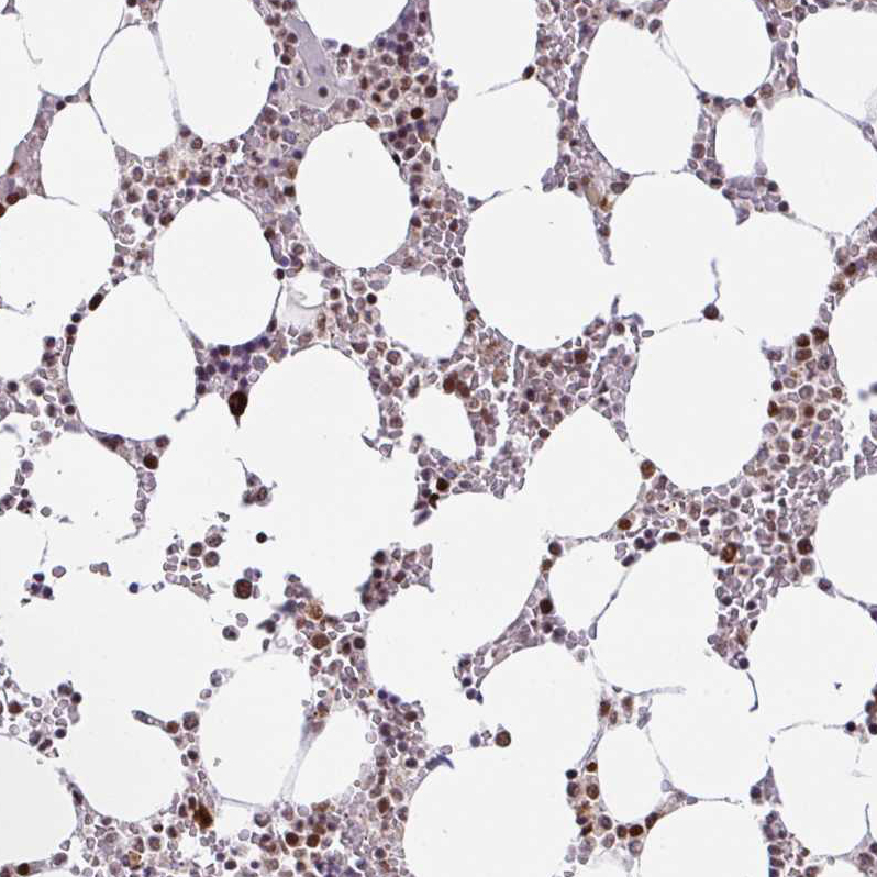Atlas Antibodies Anti-CLP1 Antibody