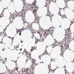 Atlas Antibodies Anti-CLP1 Antibody
