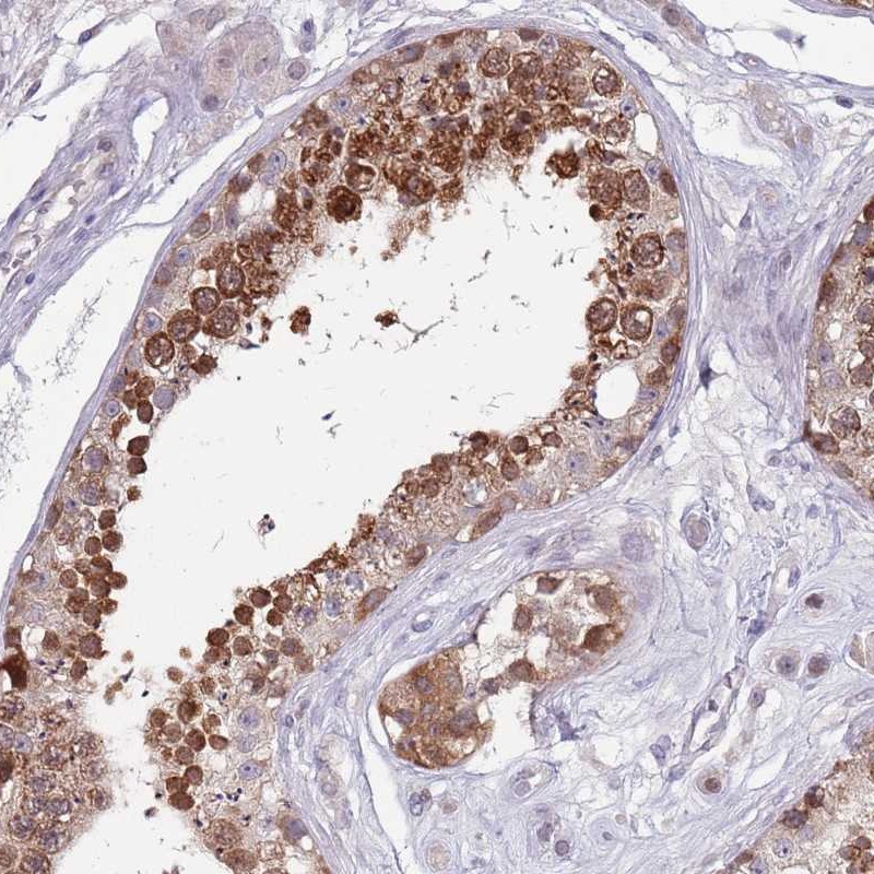 Atlas Antibodies Anti-CLNS1A Antibody