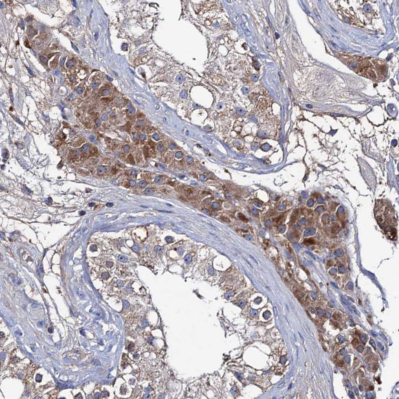 Atlas Antibodies Anti-CLPB Antibody