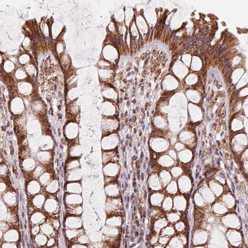 Atlas Antibodies Anti-CLPB Antibody