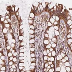 Atlas Antibodies Anti-CLPB Antibody