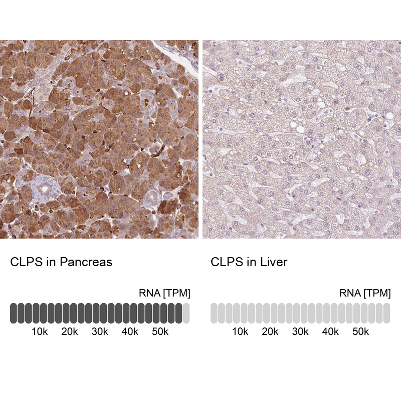 Atlas Antibodies Anti-CLPS Antibody