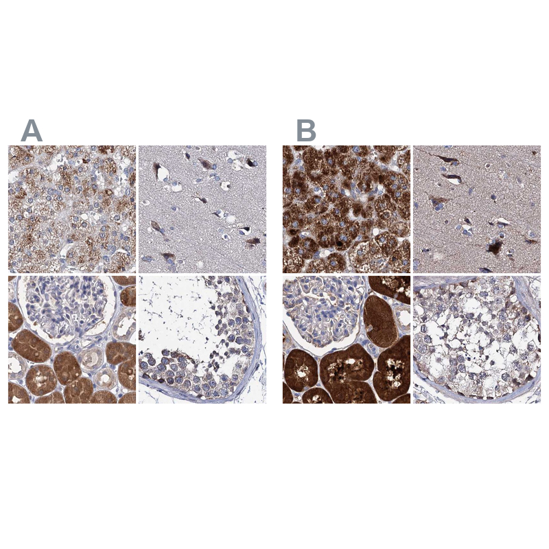 Atlas Antibodies Anti-CLPB Antibody