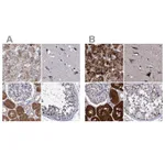 Atlas Antibodies Anti-CLPB Antibody