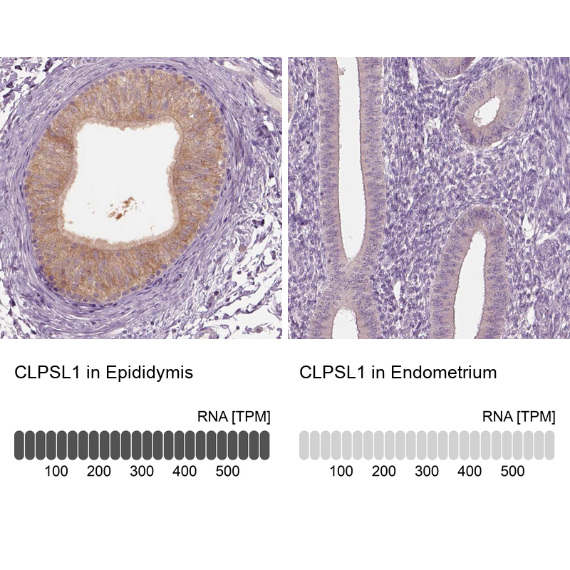 Atlas Antibodies Anti-CLPSL1 Antibody