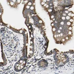 Atlas Antibodies Anti-CLPP Antibody