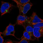 Atlas Antibodies Anti-CLPTM1 Antibody