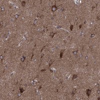 Atlas Antibodies Anti-CLPTM1 Antibody
