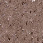 Atlas Antibodies Anti-CLPTM1 Antibody