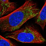 Atlas Antibodies Anti-CLPX Antibody