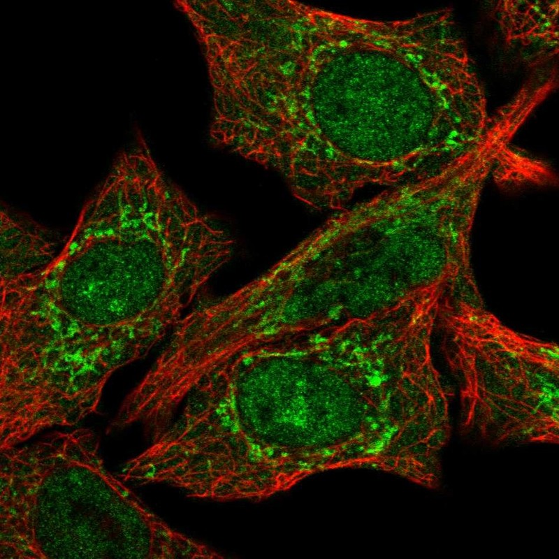 Atlas Antibodies Anti-CLPX Antibody