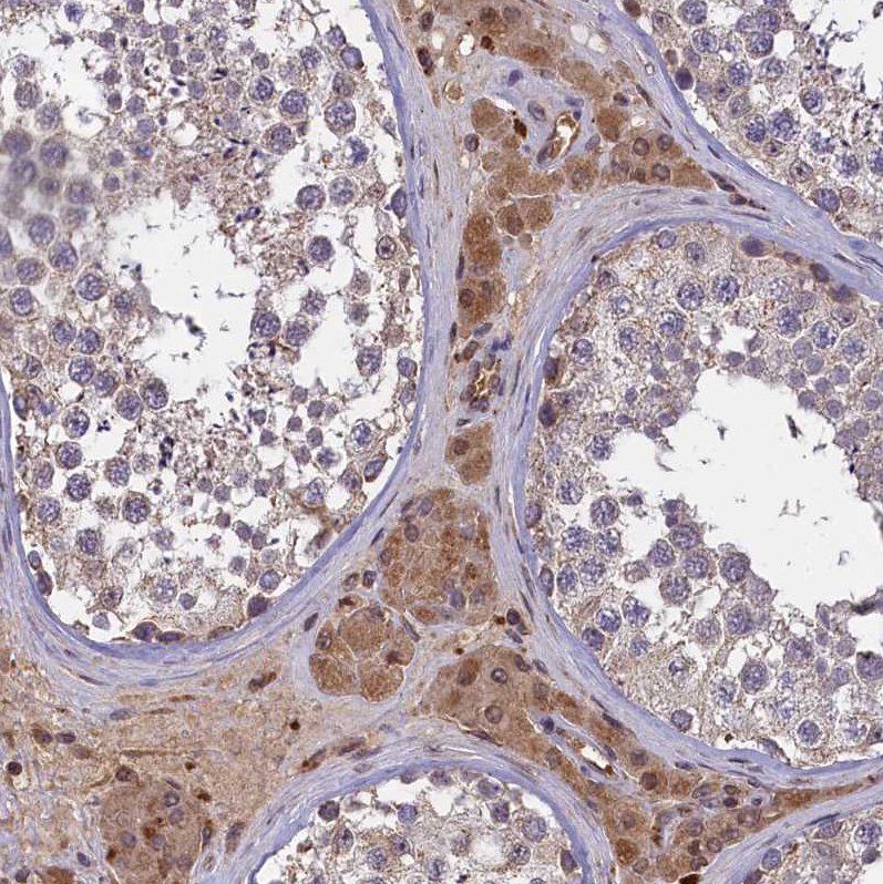 Atlas Antibodies Anti-CLRN2 Antibody