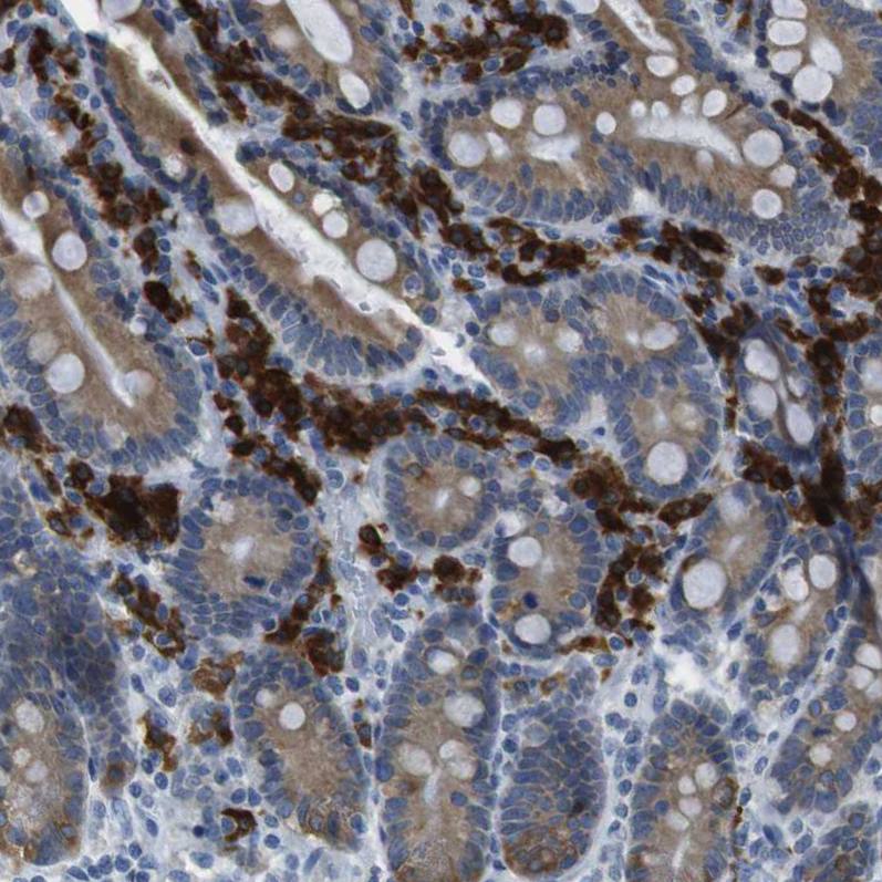 Atlas Antibodies Anti-CLPTM1L Antibody
