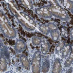 Atlas Antibodies Anti-CLPTM1L Antibody