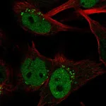 Atlas Antibodies Anti-CLSPN Antibody