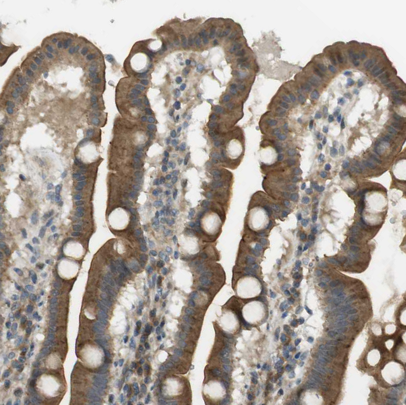 Atlas Antibodies Anti-CLRN3 Antibody