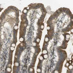 Atlas Antibodies Anti-CLRN3 Antibody