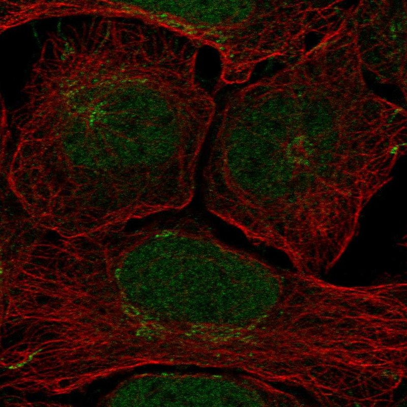 Atlas Antibodies Anti-CLSPN Antibody