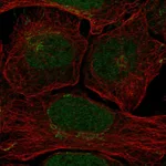 Atlas Antibodies Anti-CLSPN Antibody