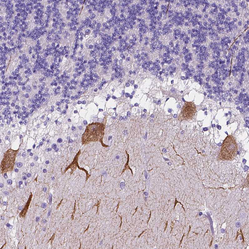 Atlas Antibodies Anti-CLSTN2 Antibody