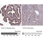 Atlas Antibodies Anti-CLTA Antibody