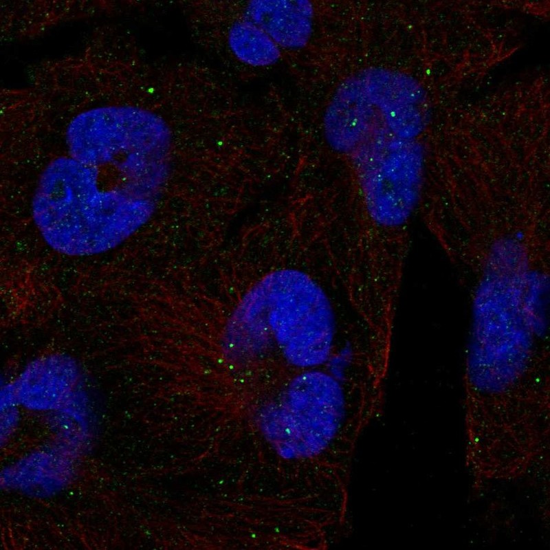 Atlas Antibodies Anti-CLTCL1 Antibody