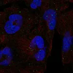 Atlas Antibodies Anti-CLTCL1 Antibody