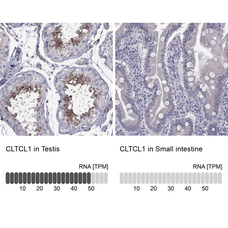 Atlas Antibodies Anti-CLTCL1 Antibody