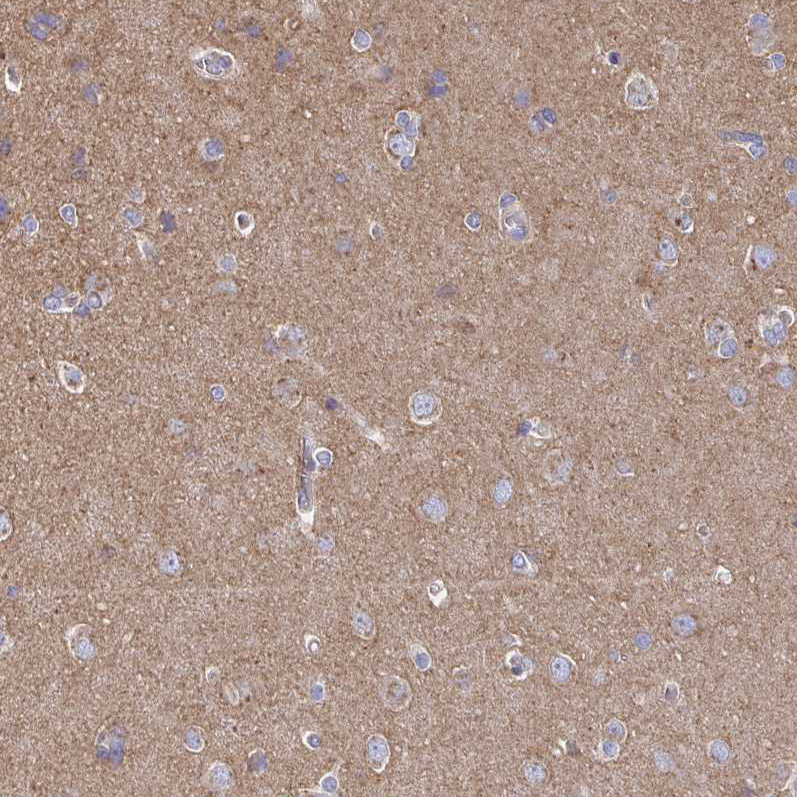 Atlas Antibodies Anti-CLTC Antibody