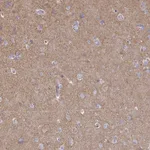 Atlas Antibodies Anti-CLTC Antibody