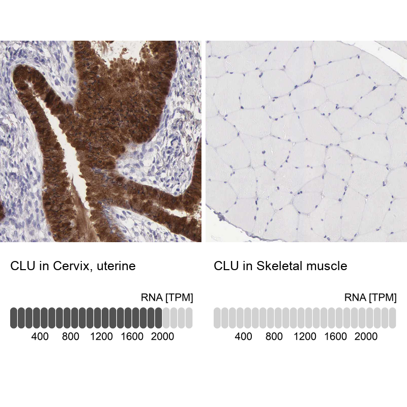 Atlas Antibodies Anti-CLU Antibody