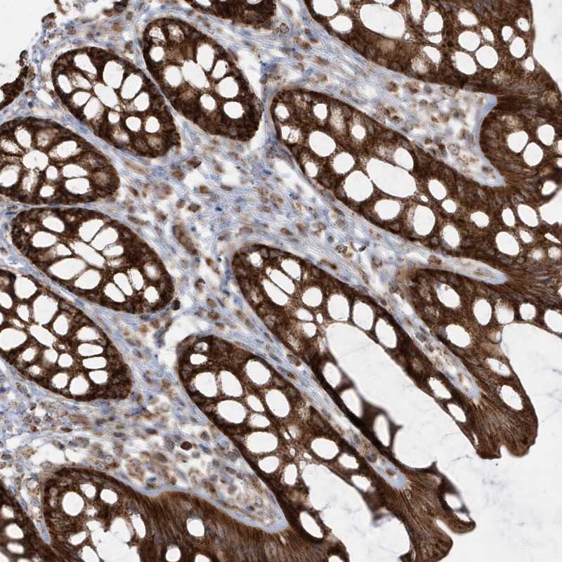 Atlas Antibodies Anti-CLUAP1 Antibody