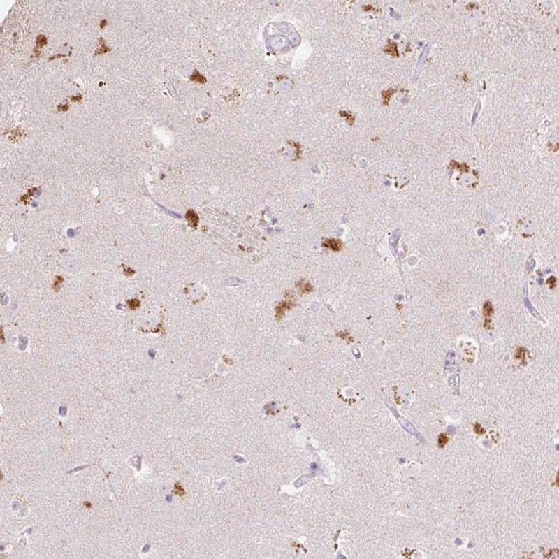 Atlas Antibodies Anti-CLVS1 Antibody