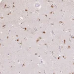 Atlas Antibodies Anti-CLVS1 Antibody