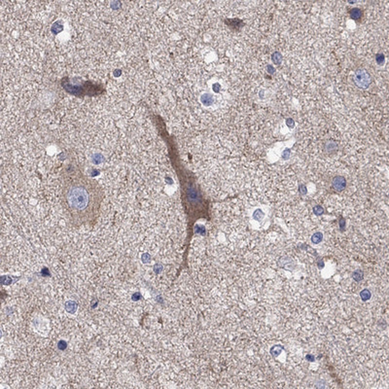 Atlas Antibodies Anti-CLVS1 Antibody