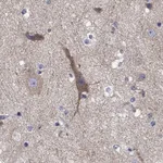 Atlas Antibodies Anti-CLVS1 Antibody