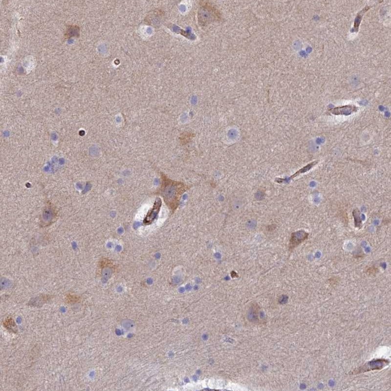 Atlas Antibodies Anti-CLVS2 Antibody