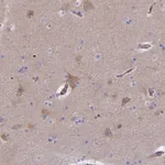 Atlas Antibodies Anti-CLVS2 Antibody