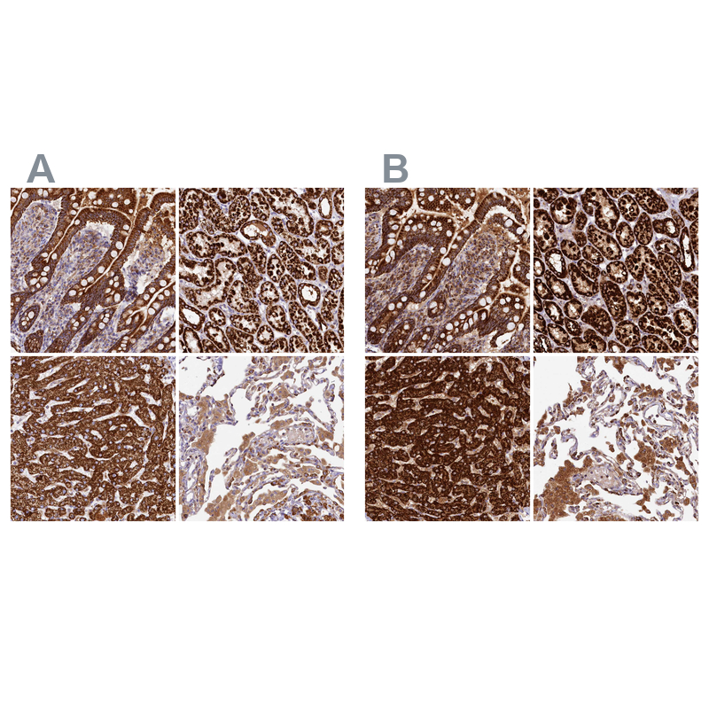 Atlas Antibodies Anti-CLYBL Antibody