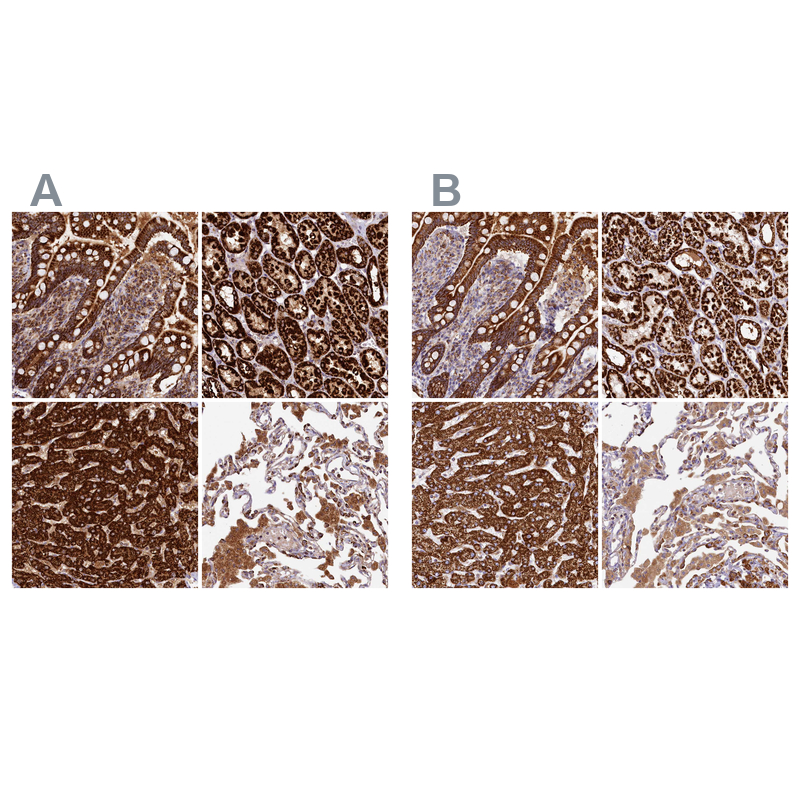 Atlas Antibodies Anti-CLYBL Antibody