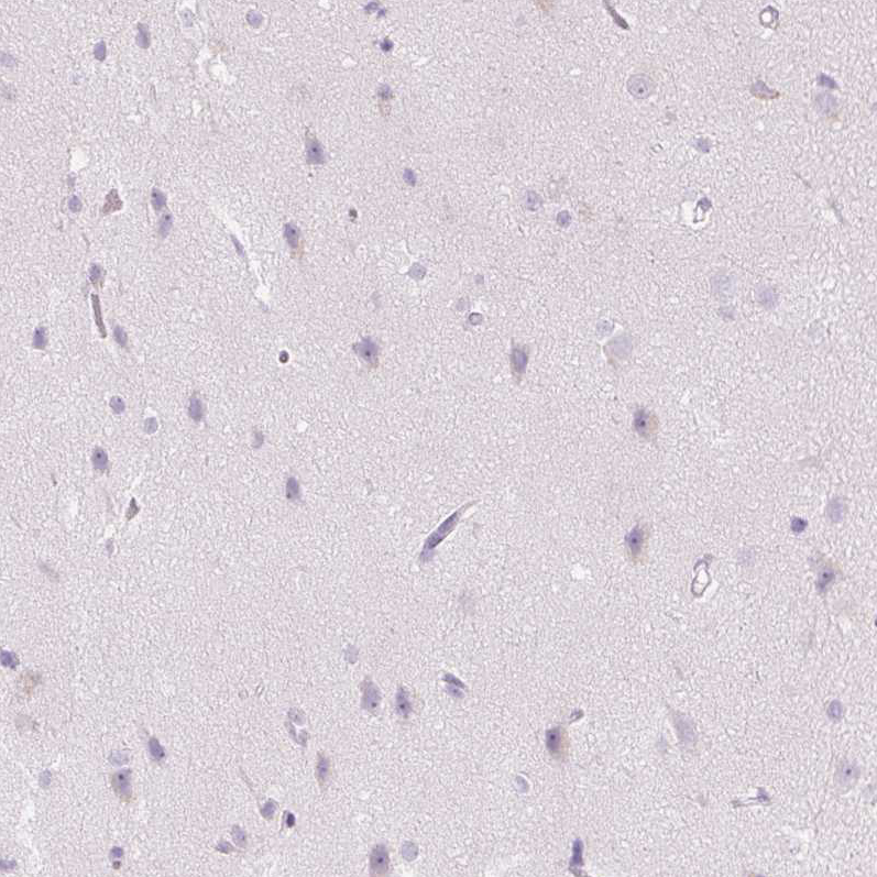 Atlas Antibodies Anti-CMA1 Antibody