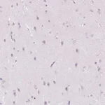 Atlas Antibodies Anti-CMA1 Antibody