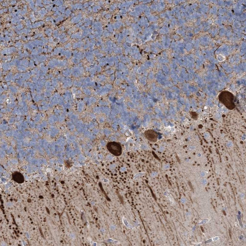 Atlas Antibodies Anti-CMBL Antibody