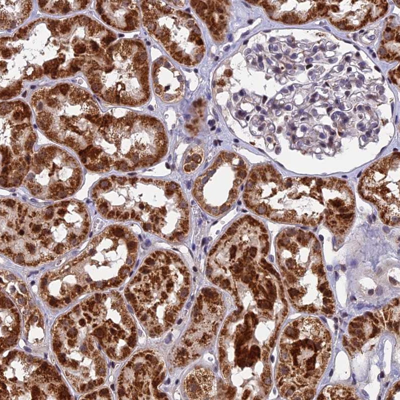 Atlas Antibodies Anti-CMC1 Antibody