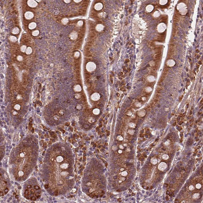 Atlas Antibodies Anti-CMIP Antibody