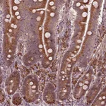 Atlas Antibodies Anti-CMIP Antibody