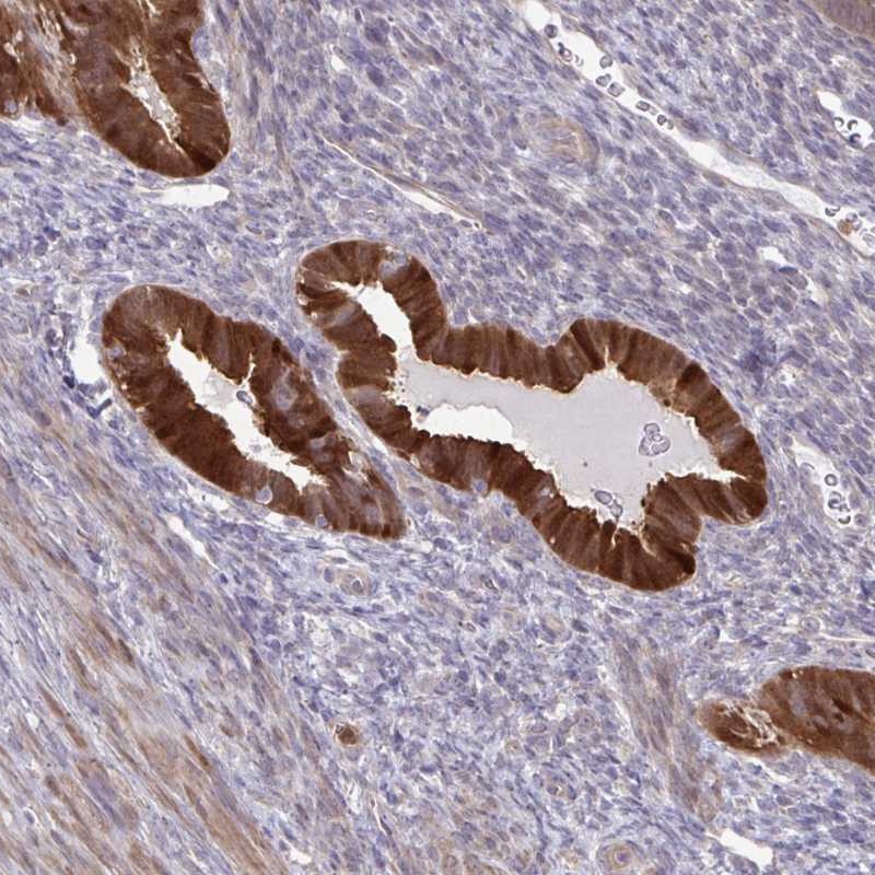 Atlas Antibodies Anti-CMPK1 Antibody
